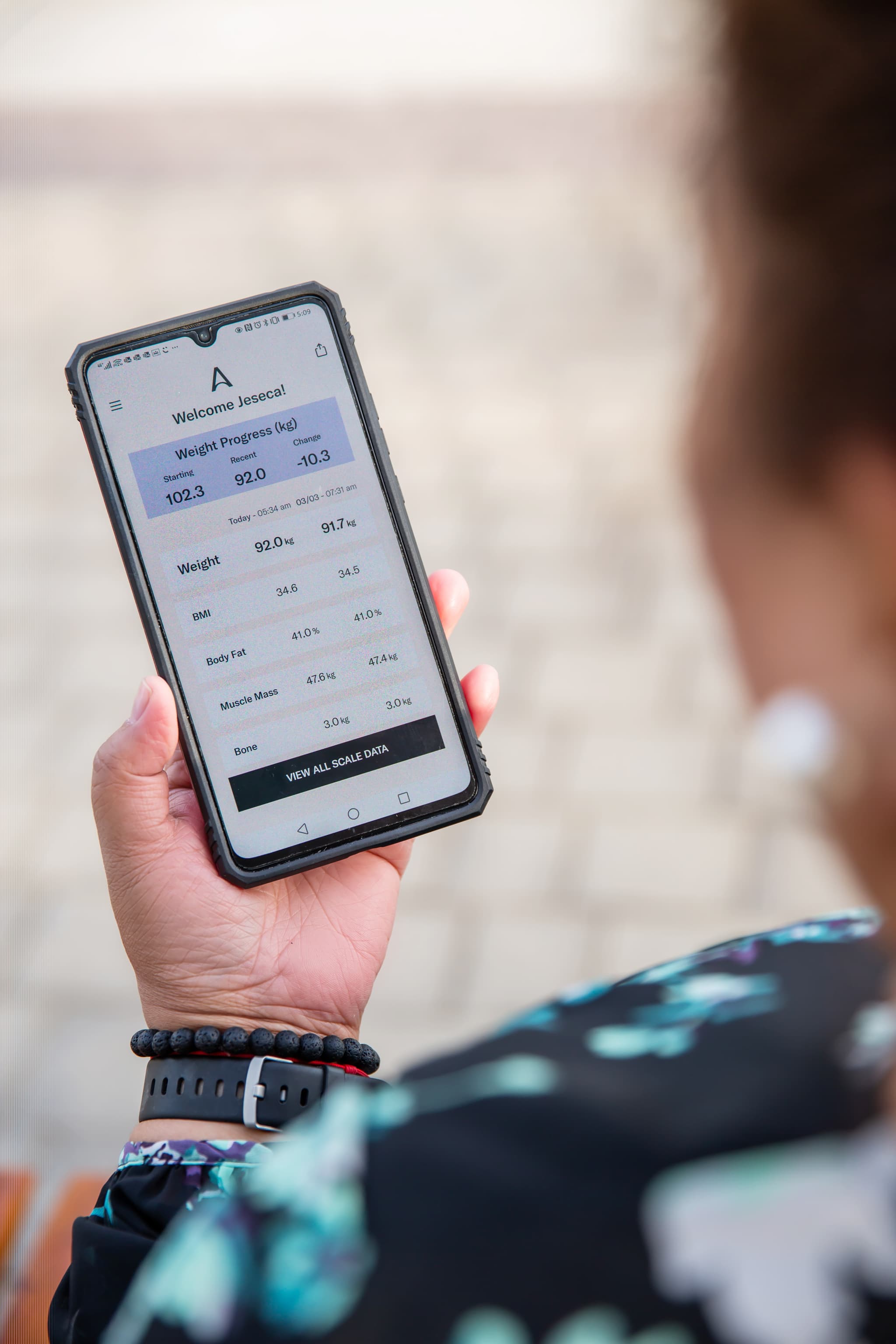 Allurion ürün detayı