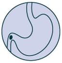 Röntgen Doğrulama & Şişirme